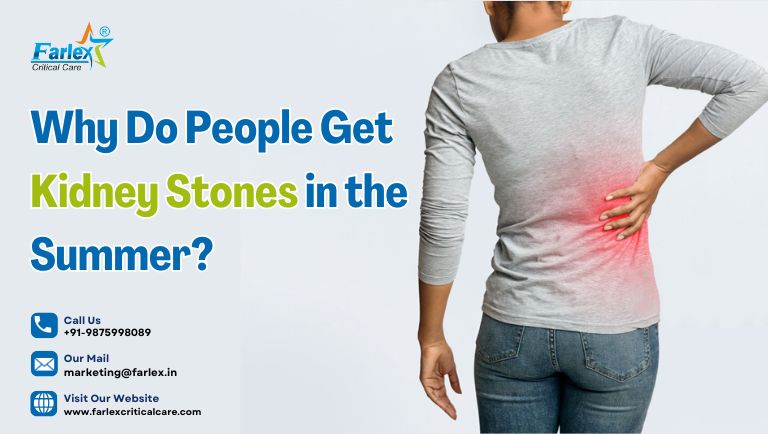 Why Do People Get Kidney Stones in the Summer?